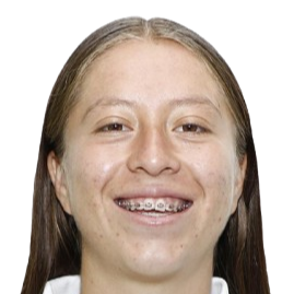 伊策尔·穆诺兹